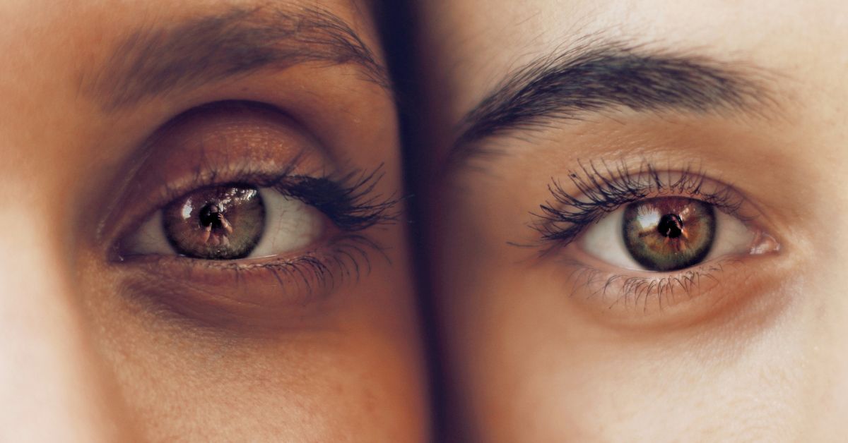 Why It’s Important to Have Clean, Healthy Eyelids featured image
