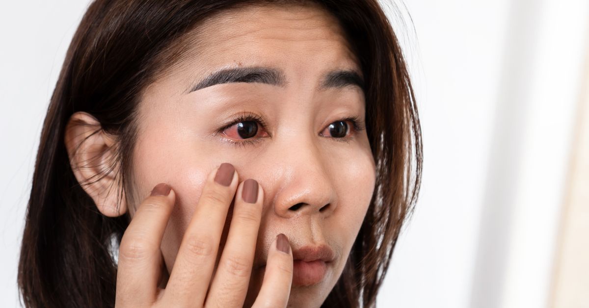 Red, Itchy, or Dry? Breaking Down Common Causes of Eye Irritation featured image